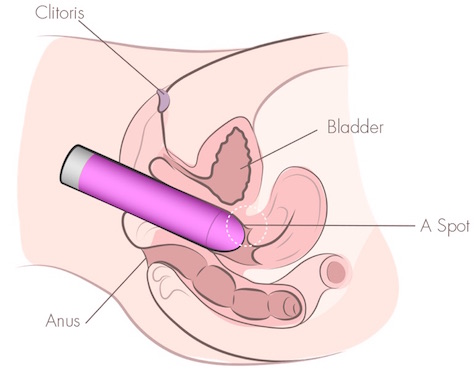 Vista em corte mostrando o vibrador inserido em direção ao Ponto A