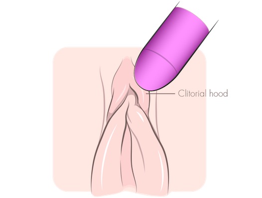 Ilustração mostrando o vibrador posicionado sobre o capuz clitoriano